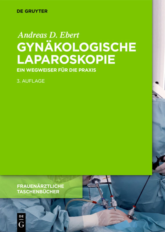 Gynäkologische Laparoskopie